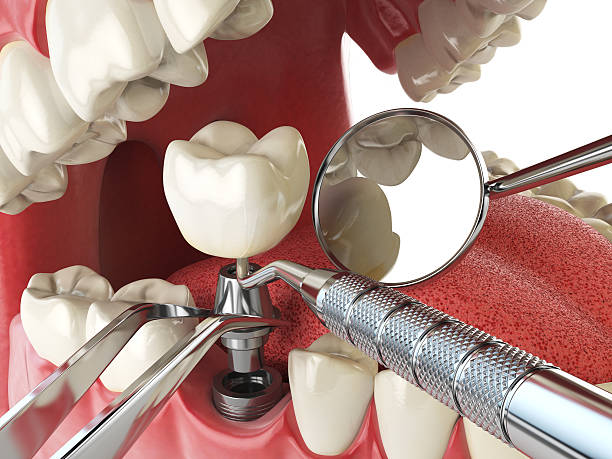 Best Emergency Dental Services for Seniors in Shattuck, OK